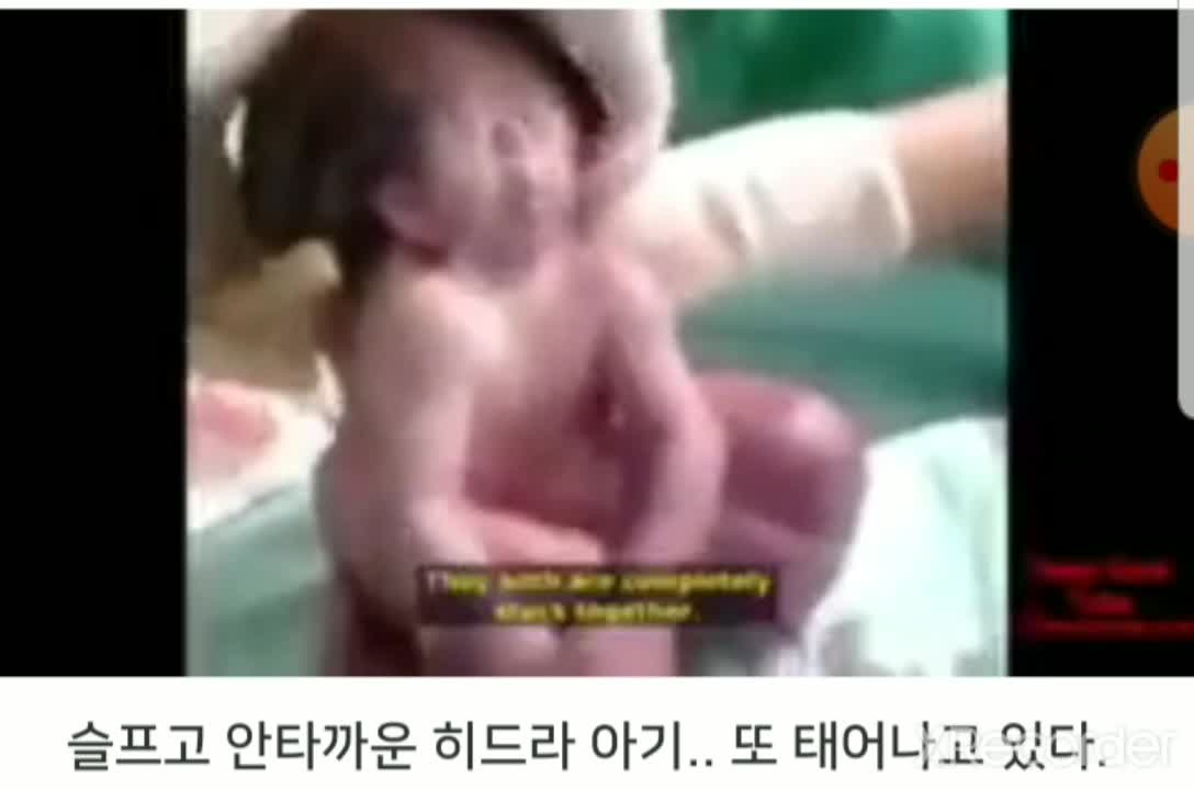접종현상(히드라 베이비)