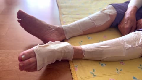 the legs of an old man with several patches