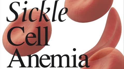 Sickle Cell News #3