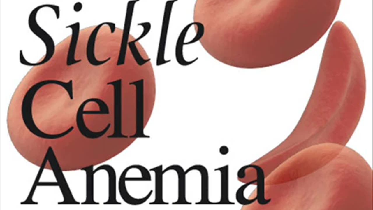 Sickle Cell News #3