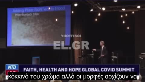 Μόνιμη και μη-αναστρέψιμη η μεταβολή στη δομή και τη λειτουργία των ερυθρών αιμοσφαιρίων