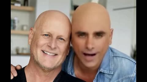 John Stamos and the Drama Of The Bald Cap.