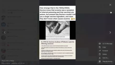 1940's and 1950's - Vaccines Caused Eczema & They Hid It