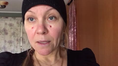 Lip rant surgery gone bad no 3