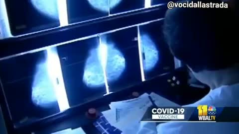 Linfonodi ingrossati mesi dopo le vaccinazioni contro il COVID-19