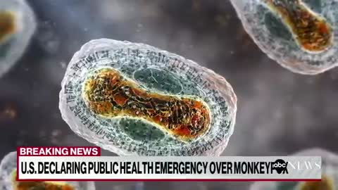 Biden administration declares monkeypox a public health emergency_batch