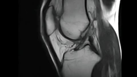 Dynamic Knee MRI