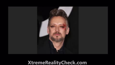 The Sleep Walkers: The Sinister Agenda Behind The Deep State Jab!! - We The People News Must Video