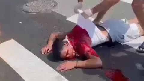 Man shot in back by illegal immigrant on scooter part 2