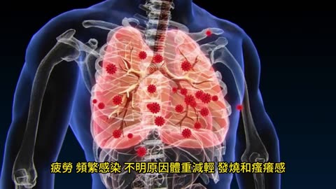 夜間盜汗 癌症早期徵兆！