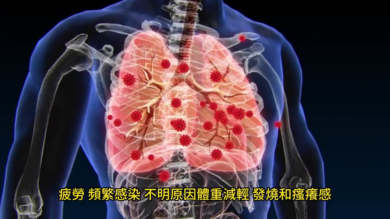 夜間盜汗 癌症早期徵兆!