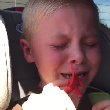 Dinosaur Stuck In Crying Boy’s Teeth