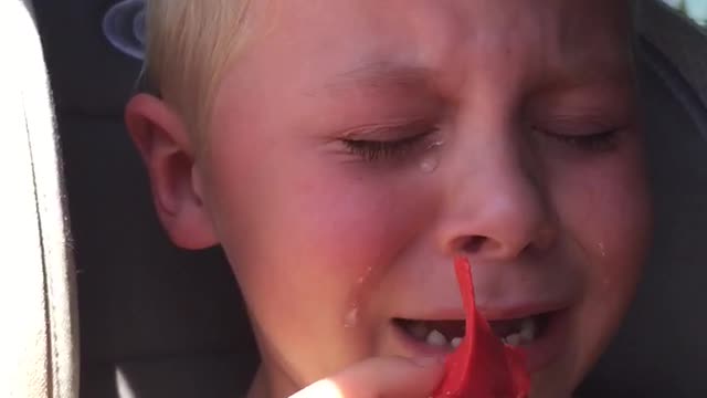 Dinosaur Stuck In Crying Boy’s Teeth