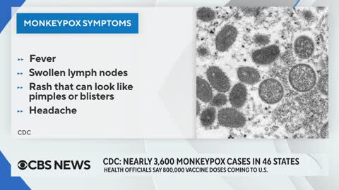 Nearly 800,000 more monkeypox vaccine doses to be available in U.S.