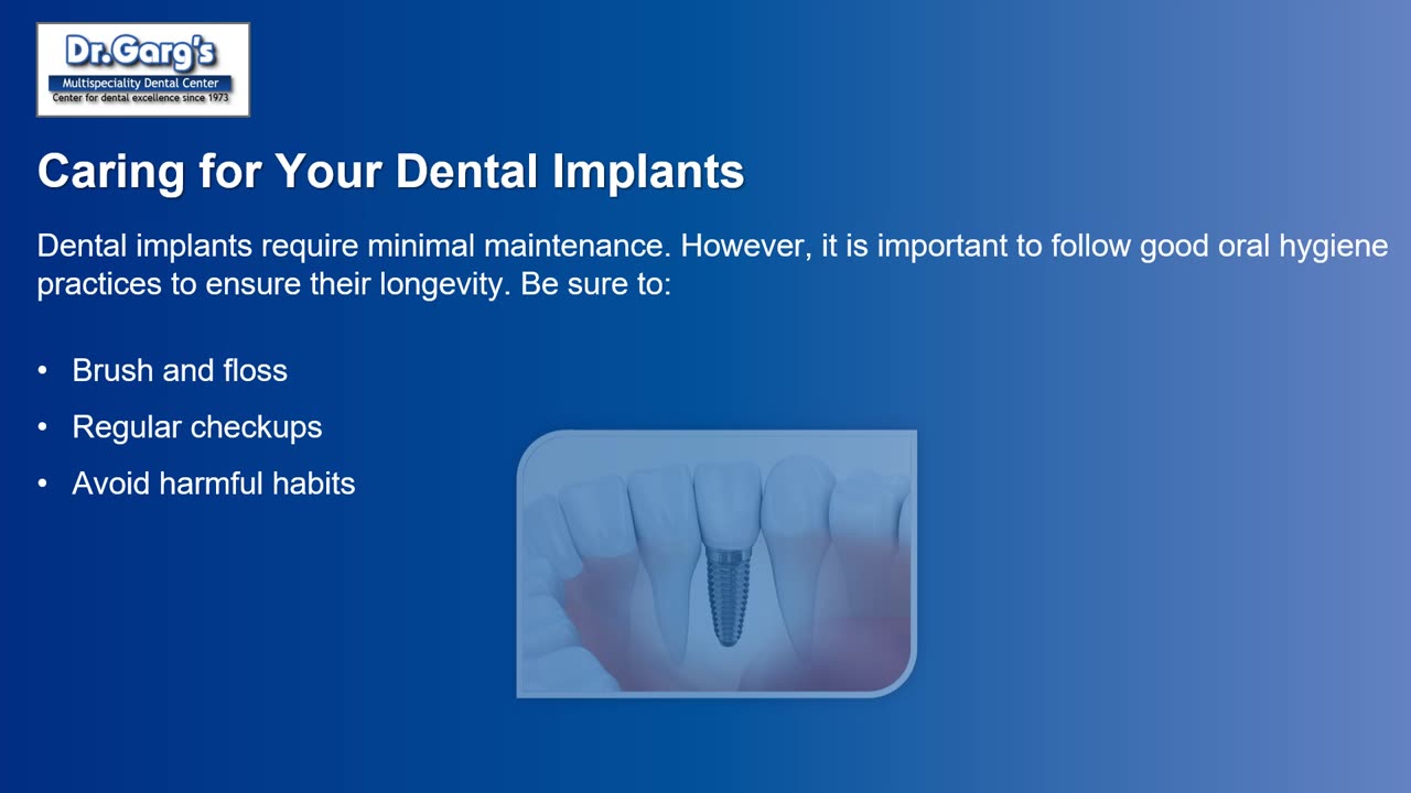 Dental Implants: The Permanent Solution to Missing Teeth