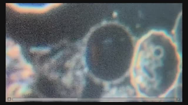 Covid vaccines: a curious discovery on the graphene oxide question