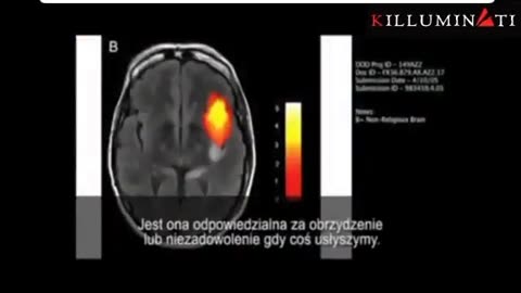 Modyfikacja genetyczna człowieka