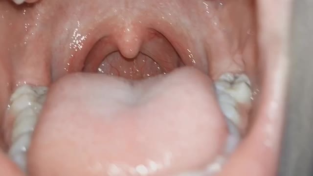 The beauty of my little sister's mouth;