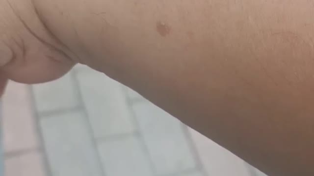 small bug