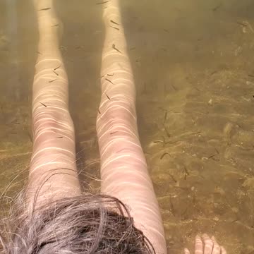 Skin therapy!! Hundreds of fishies nibbling on your legs