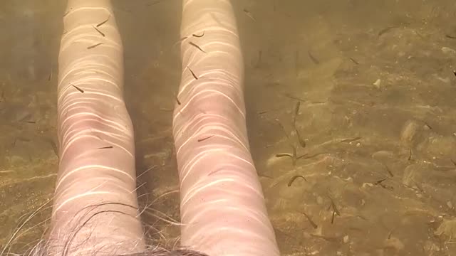 Skin therapy!! Hundreds of fishies nibbling on your legs