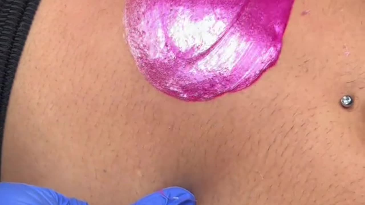 "Experience the Ultimate Smoothness: Stomach Waxing with Sexy Smooth Tickled Pink Wax! 💖✨"