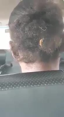 beetle walks quietly in a woman's hair