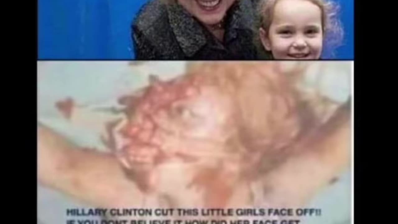 Hillary “ The Ripper “ Clinton - Raw #ADRENOCHROME