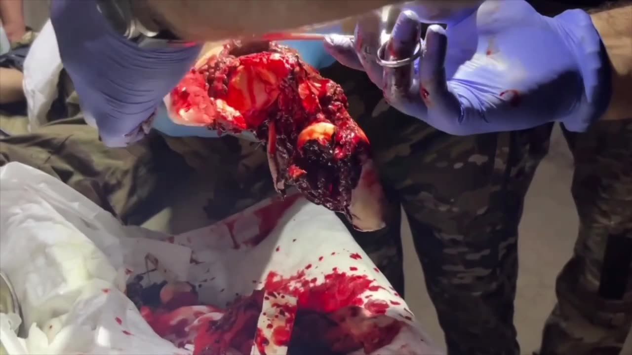 Russian medics work on wounded Russian troops in a field hospital