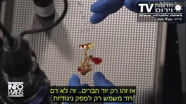 גושים של חומר בלתי מזוהה נוצר בתוך כליי הדם של מוזרקים
