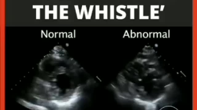 Brave Australian Emergency Department Doctor comes forward to expose the truth...