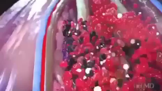 VACCINO MORTALE: CELLULE SPIKE CIRCOLANO E DANNEGGIANO..