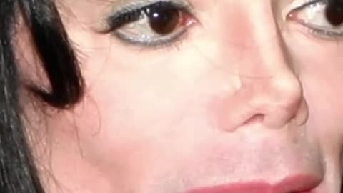 How Much Plastic Surgery Did Michael