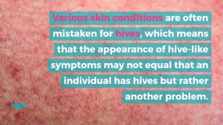 13 Serious Problems That Hives Could Indicate