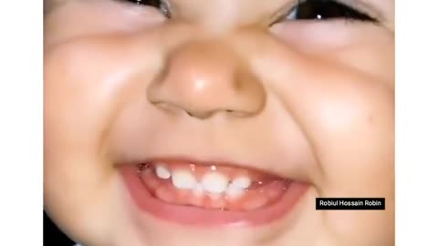 Baby Cutting hand funny video