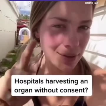 Hospitals are Organ Harvesting your babies parts