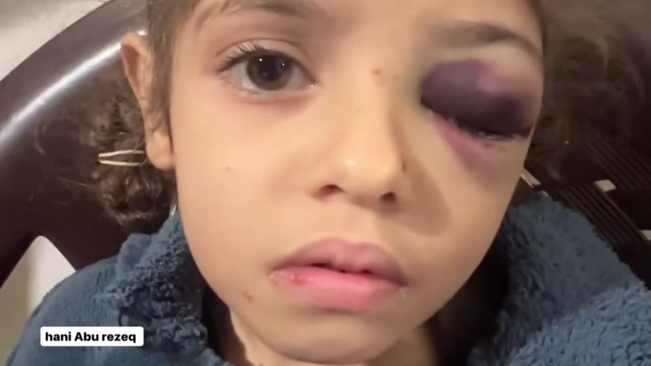 فاطمة مطر العمر خمس سنوات استشهد العديدمن عائلتها والديها، كانت معتقلة لدى جنود الاحتلال