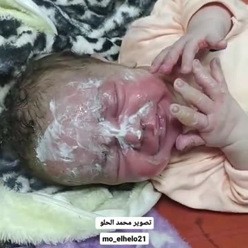 BABY SHIVERING IN GAZA IS INJURED BY SHRAPNEL BURNS BY ISRAELI BOMBING