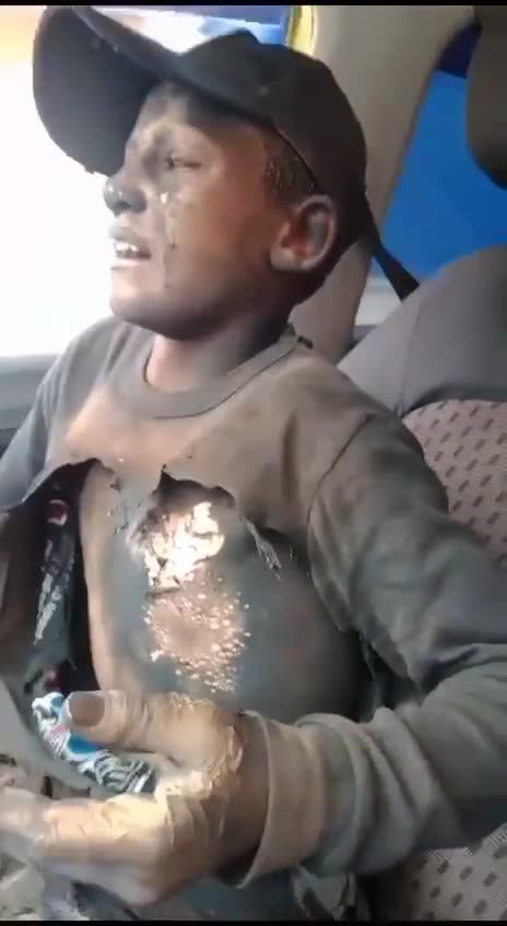 Jews attempted to burn a Palestinian child alive