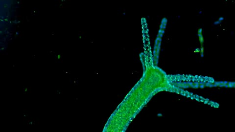 HYDRA VULGARIS INSIDE THE JAB!?