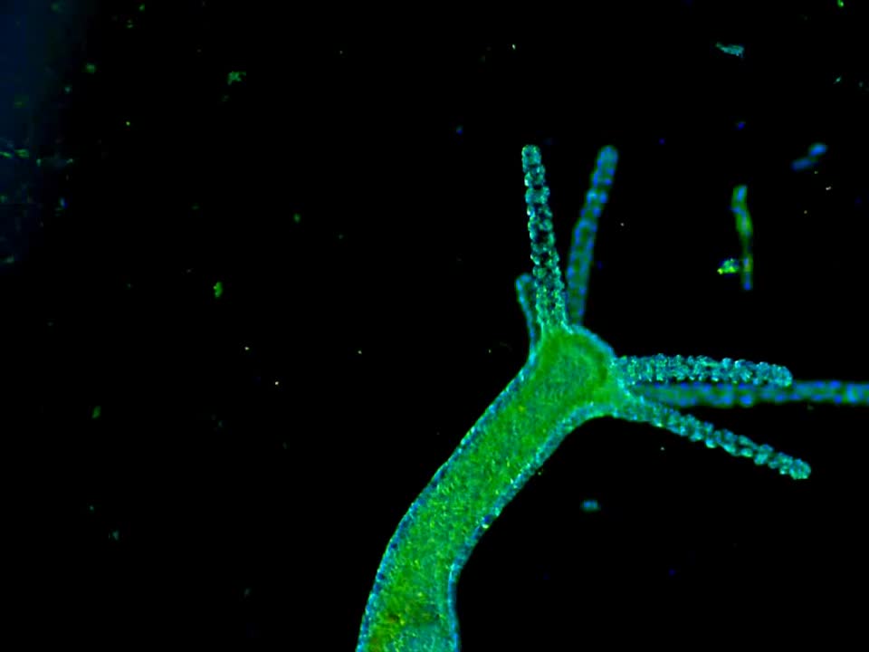 HYDRA VULGARIS INSIDE THE JAB!?