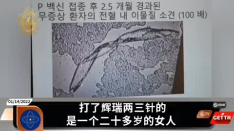正義的韓國🇰🇷醫生，揭露冠狀病毒疫苗里的“怪異生命體”
