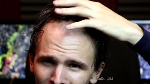 hairline joke