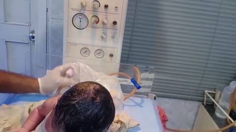 New born baby after birth cry hard