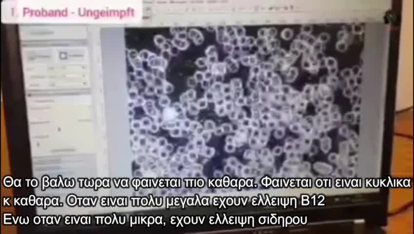 ΔΙΑΦΟΡΑ ΑΙΜΑΤΟΣ ΕΜΒΟΛΙΑΣΜΕΝΩΝ ΚΑΙ ΑΝΕΜΒΟΛΙΑΣΤΩΝ