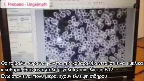 ΔΙΑΦΟΡΑ ΑΙΜΑΤΟΣ ΕΜΒΟΛΙΑΣΜΕΝΩΝ ΚΑΙ ΑΝΕΜΒΟΛΙΑΣΤΩΝ