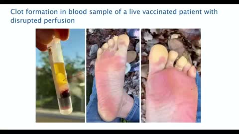 Vax becomes active and life threatening under different temperatures