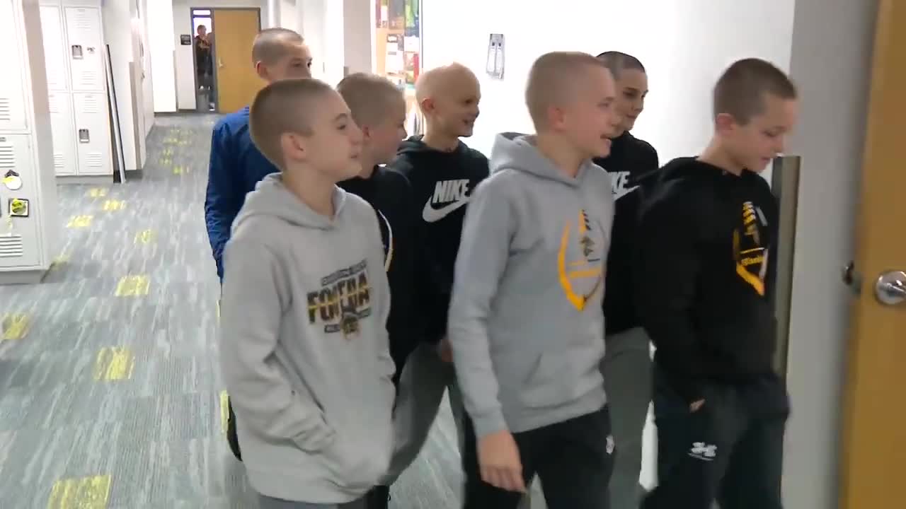 Middle schoolers shave head to support friend with alopecia_2