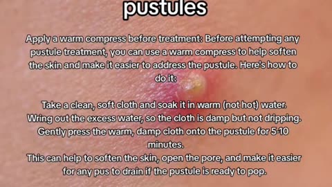 Pustules Uncovered: Clear Skin Tips! #shorts