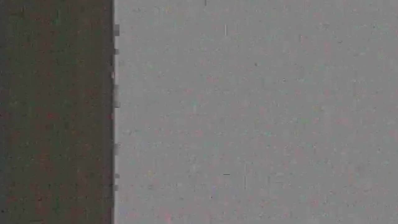Sleep stream. Recovering from surgery